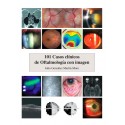 101 CASOS CLINICOS DE OFTALLMOLOGIA CON IMAGEN