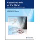 OSTEOSYNTHESIS OF THE HAND. INSTRUMENTS, IMPLANTS AND TECHNIQUES