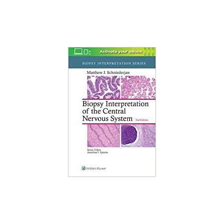 BIOPSY INTERPRETATION OF THE CENTRAL NERVOUS SYSTEM
