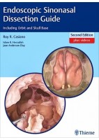 ENDOSCOPIC SINONASAL DISSECTION GUIDE. INCLUDING ORBIT AND SKULL BASE