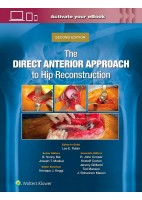 THE DIRECT ANTERIOR APPROACH TO HIP RECONSTRUCTION (EBOOK INCLUDED)