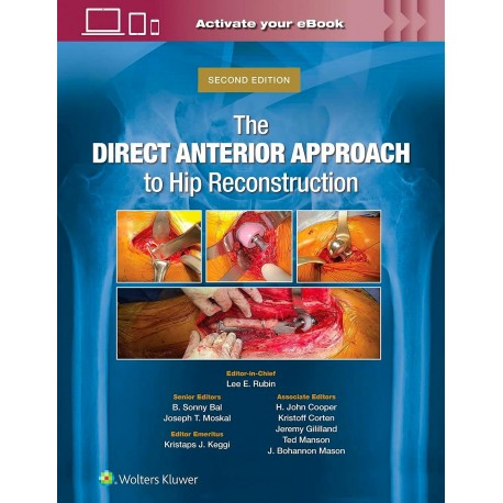 THE DIRECT ANTERIOR APPROACH TO HIP RECONSTRUCTION (EBOOK INCLUDED)