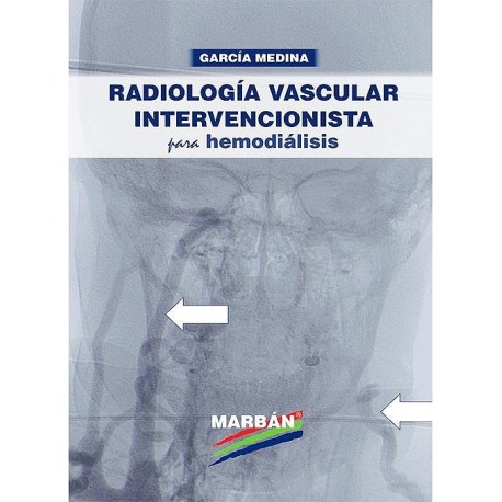 RADIOLOGIA VASCULAR INTERVENCIONISTA PARA HEMODIALISIS