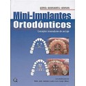 MINI-IMPLANTES ORTODONTICOS