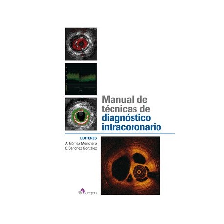MANUAL DE TECNICAS DE DIAGNOSTICO INTRACORONARIO