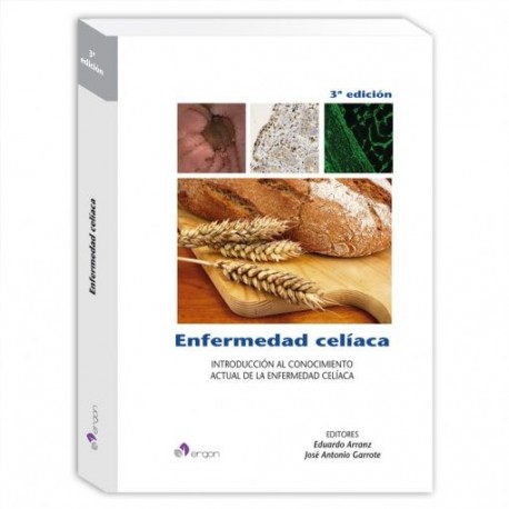 ENFERMEDAD CELIACA INTRODUCCION AL CONOCIMIENTO ACTUAL DE LA ENFERMEDAD CELIACA