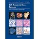 WHO CLASSIFICATION OF TUMOURS: SOFT TISSUE AND BONE TUMOURS
