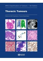 WHO CLASSIFICATION OF TUMOURS: THORACIC TUMOURS