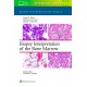 BIOPSY INTERPRETATION OF THE BONE MARROW