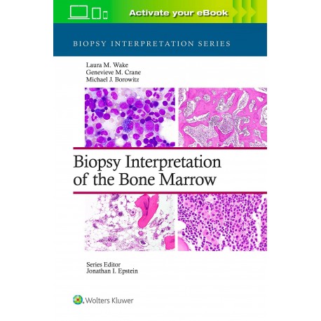 BIOPSY INTERPRETATION OF THE BONE MARROW
