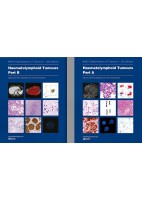 WHO CLASSIFICATION OF TUMOURS: HAEMATOLYMPHOID TUMOURS. PART A AND B (2 VOLUME SET)