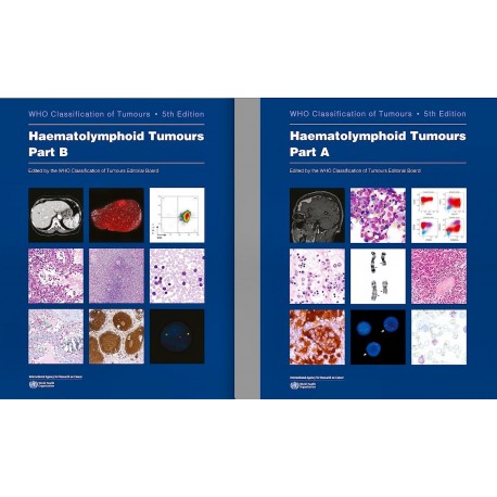 WHO CLASSIFICATION OF TUMOURS: HAEMATOLYMPHOID TUMOURS. PART A AND B (2 VOLUME SET)