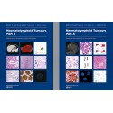 WHO CLASSIFICATION OF TUMOURS: HAEMATOLYMPHOID TUMOURS. PART A AND B (2 VOLUME SET)
