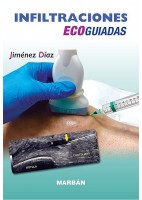 INFILTRACIONES ECOGUIADAS PREMIUM