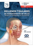 RELLENOS TISULARES DE HIDROXIAPATITA DE CALCIO. TECNICAS DE TRATAMIENTO DE LOS EXPERTOS