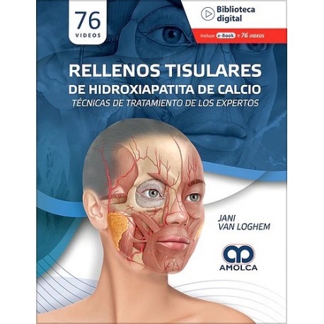 RELLENOS TISULARES DE HIDROXIAPATITA DE CALCIO. TECNICAS DE TRATAMIENTO DE LOS EXPERTOS