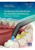 CEMENTACION ADHESIVA EN DIENTES NATURALES. MATERIALES Y TECNICAS