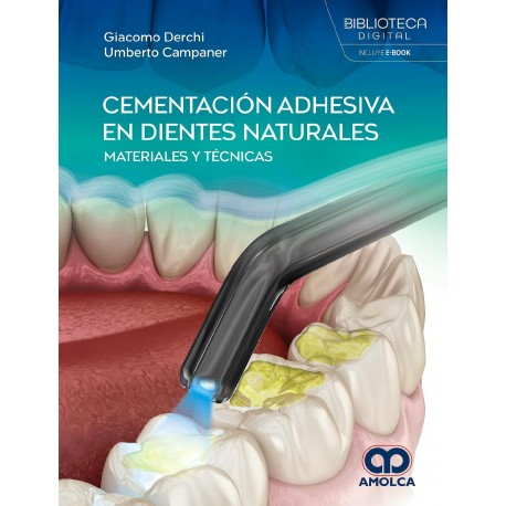 CEMENTACION ADHESIVA EN DIENTES NATURALES. MATERIALES Y TECNICAS