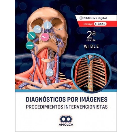 DIAGNOSTICOS POR IMAGENES. PROCEDIMIENTOS INTERVENCIONISTAS