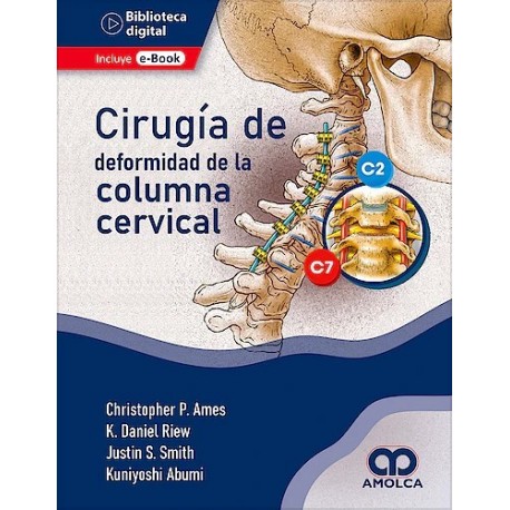 CIRUGIA DE LA DEFORMIDAD DE LA COLUMNA CERVICAL