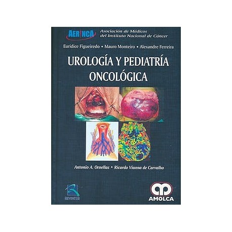 UROLOGIA Y PEDIATRIA ONCOLOGICA