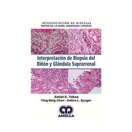 INTERPRETACION DE BIOPSIA DEL RIÑON Y GLANDULA SUPRARRENAL (INTERPRETACION DE BIOPSIAS)