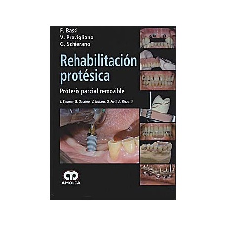 REHABILITACION PROTESICA. PROTESIS PARCIAL REMOVIBLE