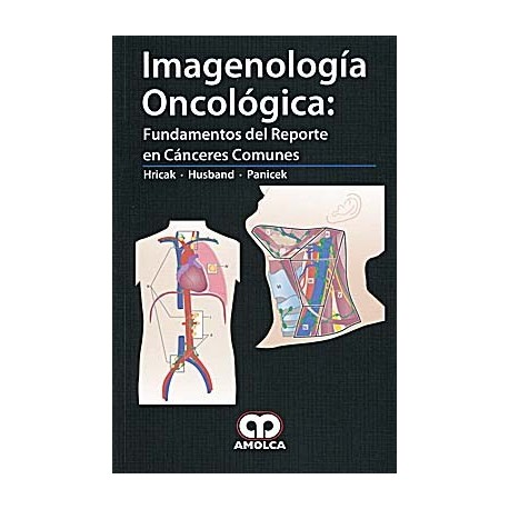 IMAGENOLOGIA ONCOLOGICA: FUNDAMENTOS DEL REPORTE EN CANCERES COMUNES