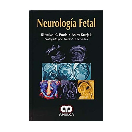 NEUROLOGIA FETAL