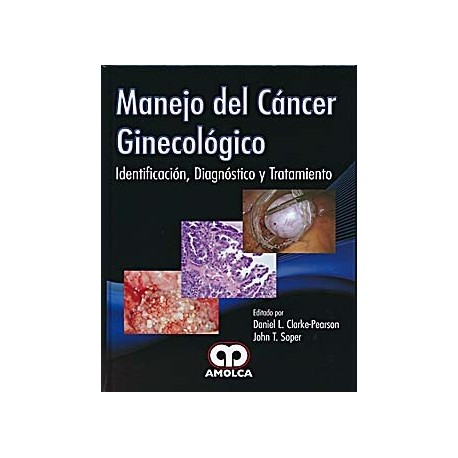MANEJO DE CANCER GINECOLOGICO