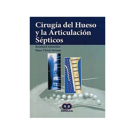 CIRUGIA DEL HUESO Y LA ARTICULACION SEPTICOS
