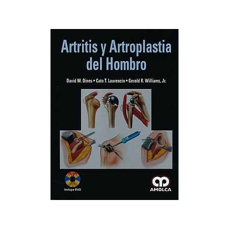 ARTRITIS Y ARTROPLASTIA DEL HOMBRO + DVD