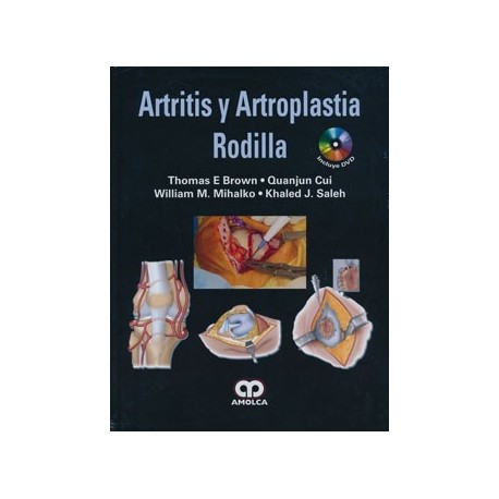 ARTRITIS Y ARTROPLASTIA DE RODILLA + DVD