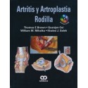 ARTRITIS Y ARTROPLASTIA DE RODILLA + DVD