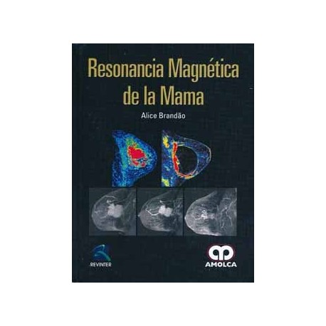 RESONANCIA MAGNETICA DE LA MAMA