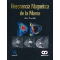 RESONANCIA MAGNETICA DE LA MAMA