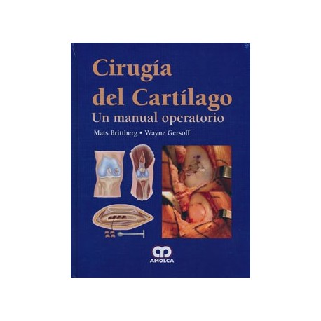 CIRUGIA DEL CARTILAGO. UN MANUAL OPERATORIO