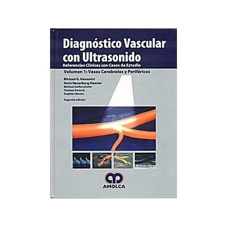 DIAGNOSTICO VASCULAR CON ULTRASONIDO, VOL. I: VASOS CEREBRALES Y PERIFERICOS