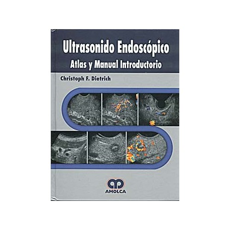 ULTRASONIDO ENDOSCOPICO