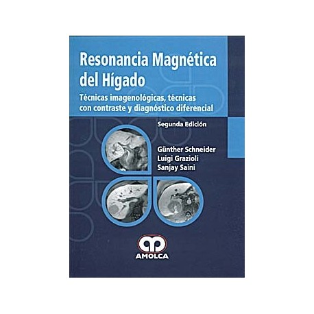 RESONANCIA MAGNETICA DEL HIGADO