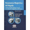 RESONANCIA MAGNETICA DEL HIGADO