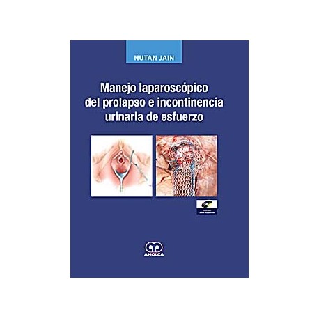 MANEJO LAPAROSCOPICO DEL PROLAPSO E INCONTINENCIA URINARIA DE ESFUERZO + DVD