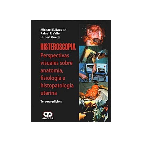 HISTEROSCOPIA. PERSPECTIVAS VISUALES DE LA ANATOMIA, FISIOLOGIA E HISTOPATOLOGIA UTERINA