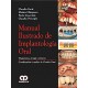 MANUAL ILUSTRADO DE IMPLANTOLOGIA ORAL. DIAGNOSTICO, CIRUGIA Y PROTESIS