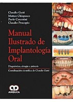 MANUAL ILUSTRADO DE IMPLANTOLOGIA ORAL. DIAGNOSTICO, CIRUGIA Y PROTESIS