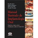 MANUAL ILUSTRADO DE IMPLANTOLOGIA ORAL. DIAGNOSTICO, CIRUGIA Y PROTESIS