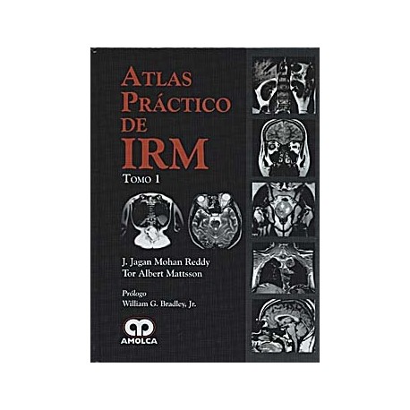 ATLAS PRACTICO DE IRM, 2 VOLS.