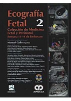 ECOGRAFIA FETAL. 2 SEMANA 11-14 DE EMBARAZO + DVD (COLECCIÃ N MEDICINA FETAL Y PERINATAL)