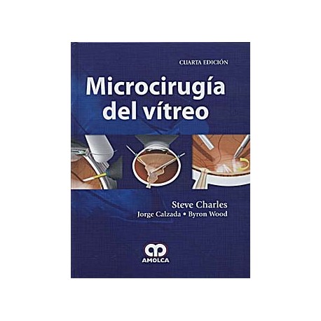 MICROCIRUGIA DEL VITREO