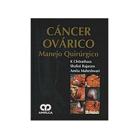 CANCER OVARICO. MANEJO QUIRURGICO